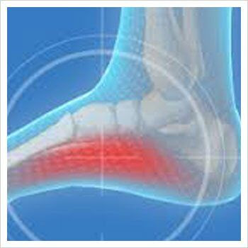Dr Craig- ARCh / Heel pain